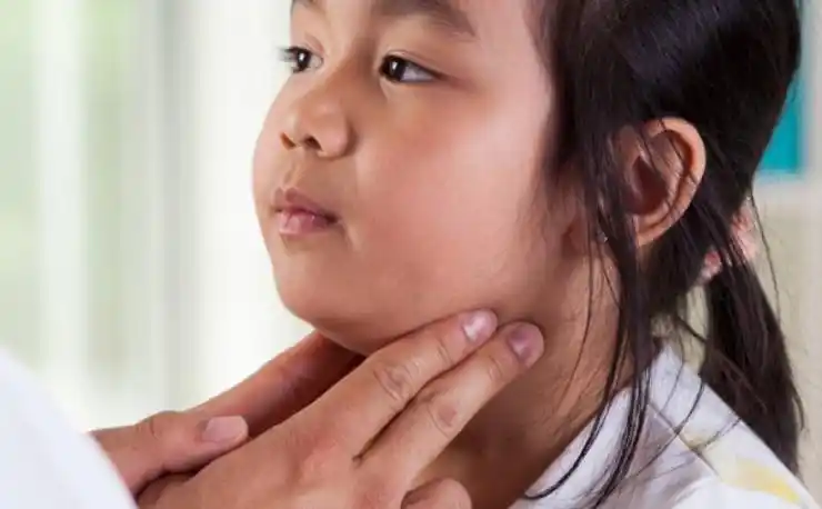 136 de 200 casos de paperas en Entre Ríos son de Gualeguaychú