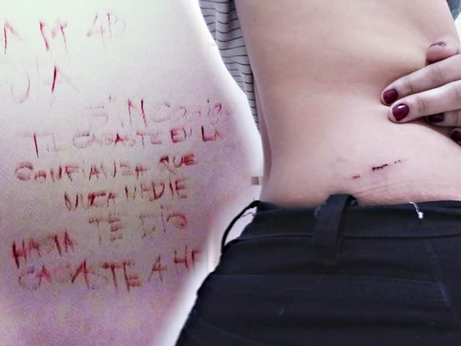 Violencia de Genero: golpes y pintadas con sangre