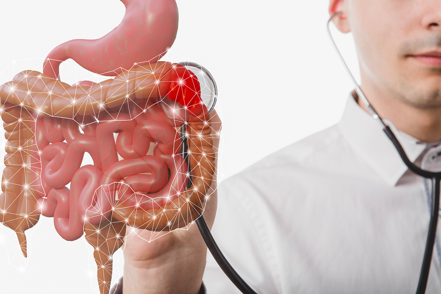 Cáncer de colon: la importancia de la prevención y la detección temprana