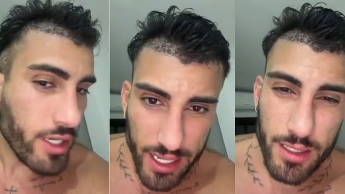 Tomás Holder mostró su implante capilar: “Tenía entradas y quería cambiarlo”