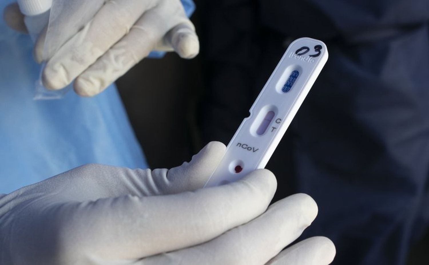 Pruebas rápidas de Covid-19 no cubre demanda: un mes se tardan en llegar resultados de PCR a hospitales