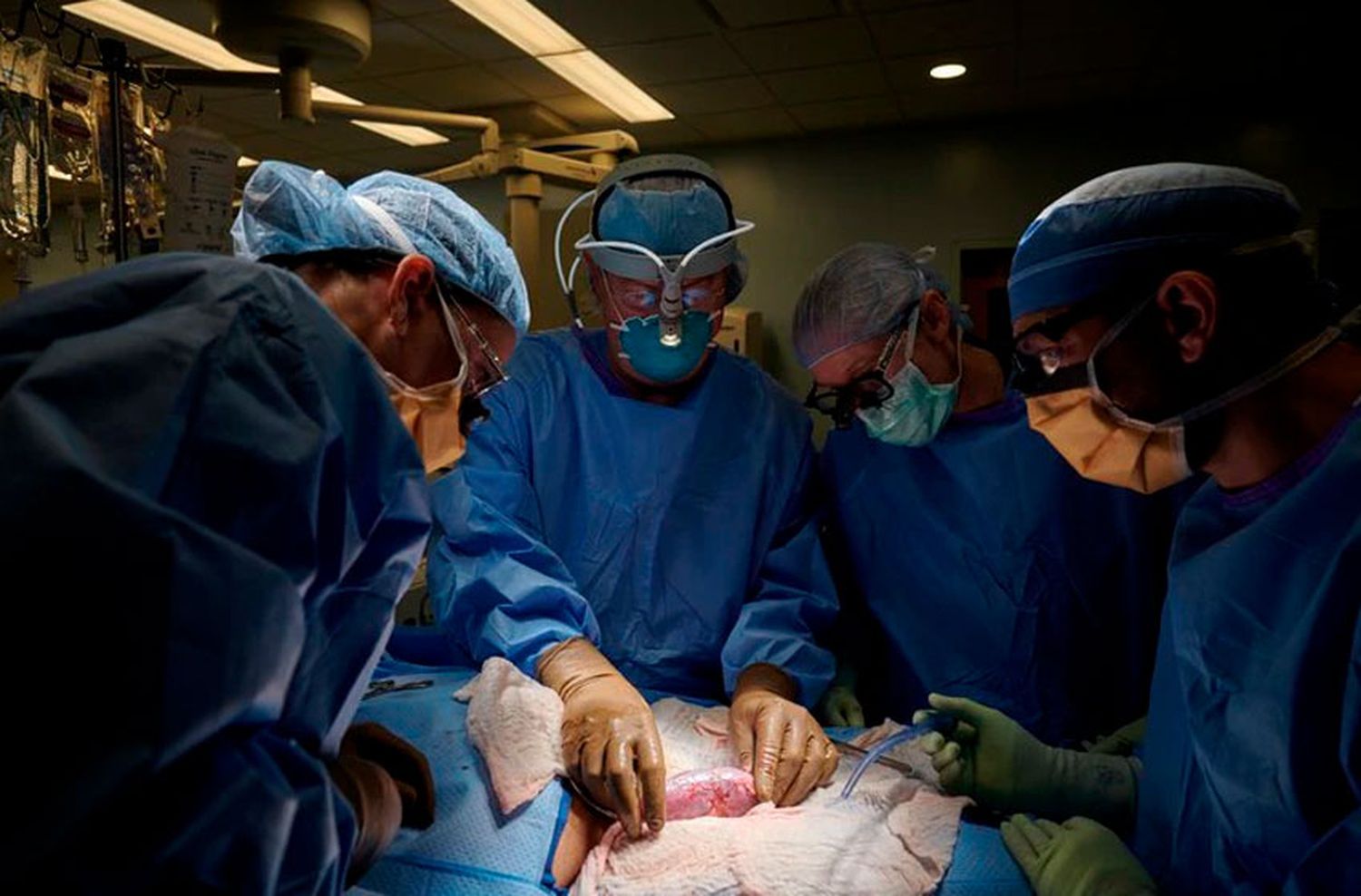En 2021 se realizaron más de 3.000 trasplantes de órganos y córneas