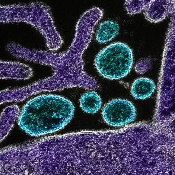 Qué saben los científicos del peligroso patógeno detectado en India