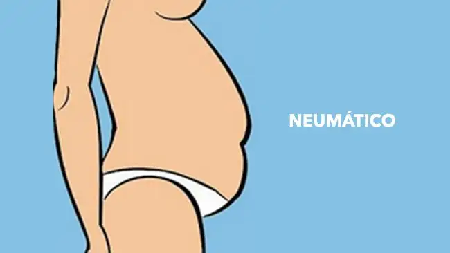 Barriga