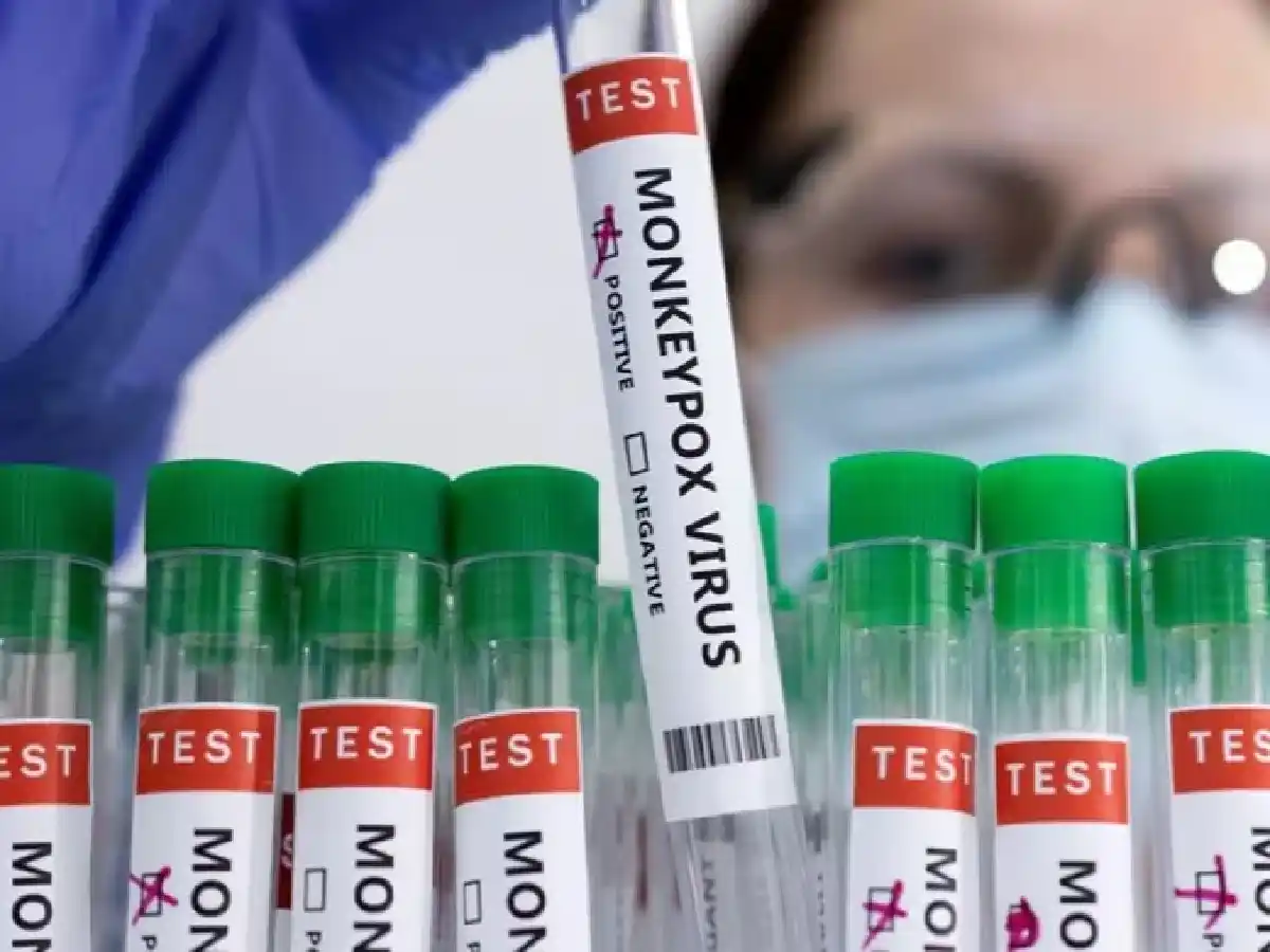 La OMS decretó el fin de la pandemia por la viruela del mono