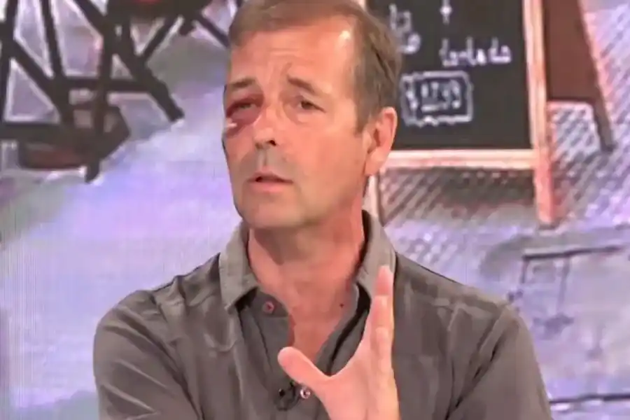 Un periodista de América fue víctima de un robo, tras ser herido, tuvo que ser intervenido quirúrgicamente