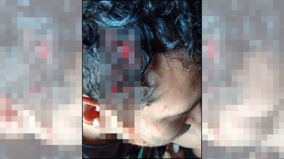 Intentaron robarle y lo golpearon en la cabeza