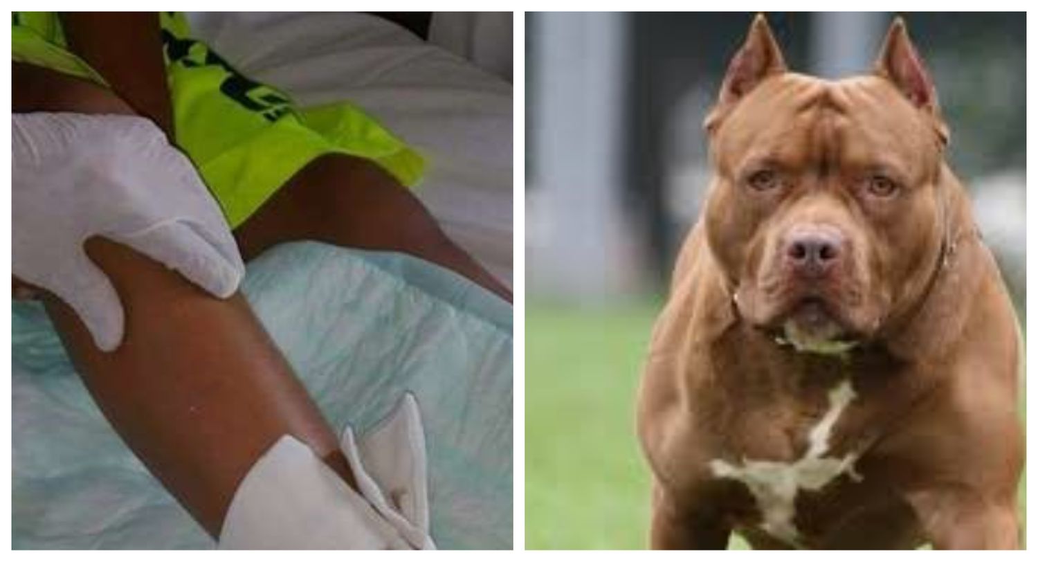 Tandil: Un niño fue ferozmente atacado por un Pitbull y permanece internado