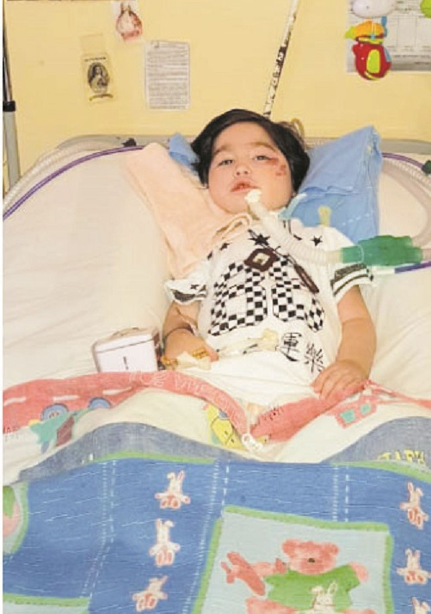 Un niño lucha por su vida en el San Blas