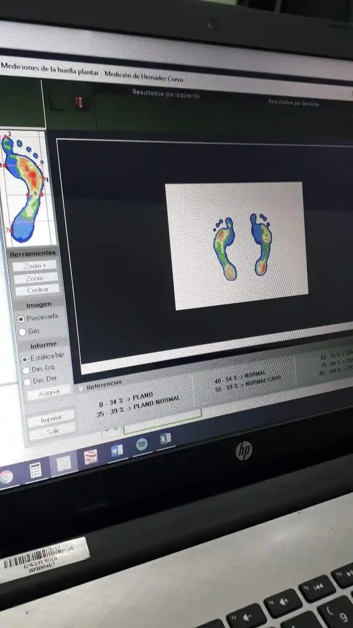 KMG trabaja con el Centro Ortopédico Peláez