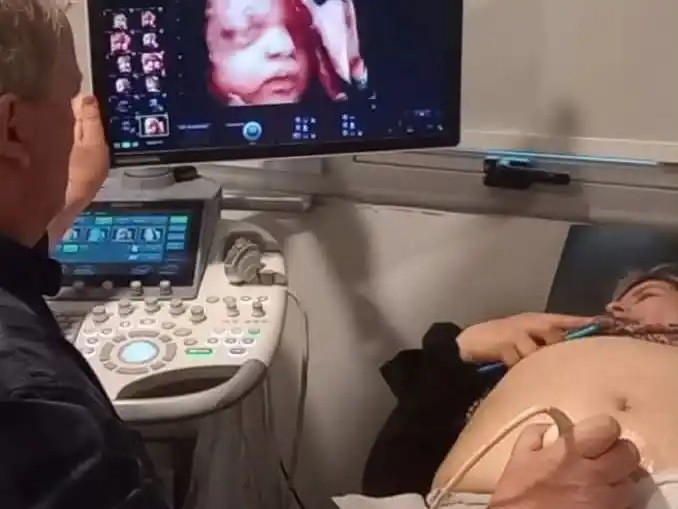 Semana del parto respetado: cómo interviene la embarazada sobre la forma en la que va a nacer su hijo