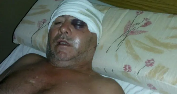 Hombre fue brutalmente golpeado por la expareja de su hija