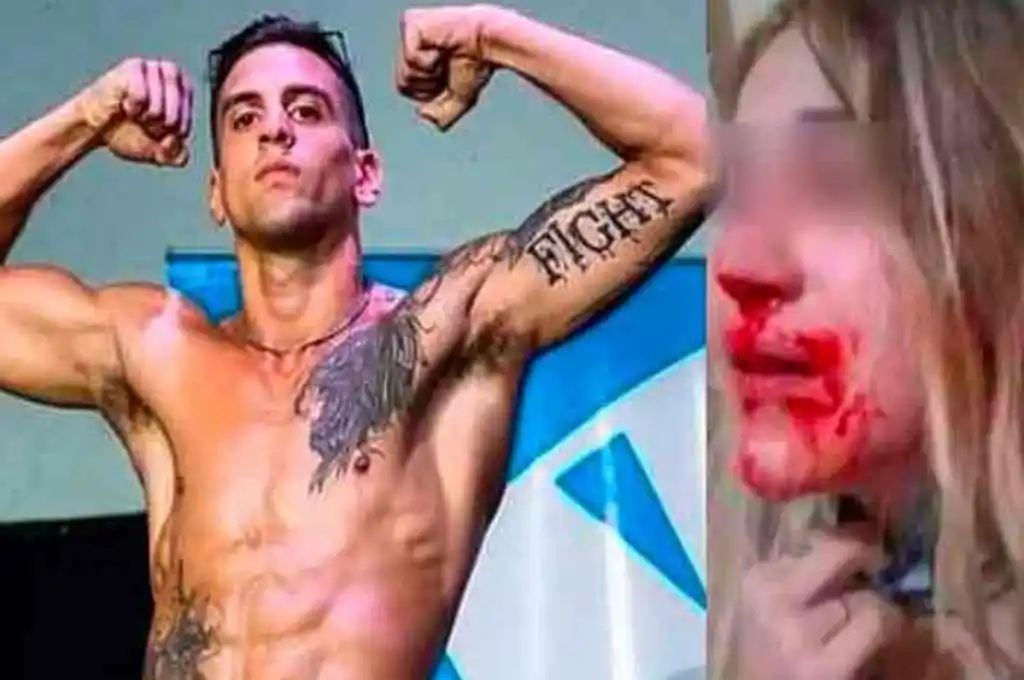 Luchador de artes marciales mixtas desfiguró a su pareja embarazada