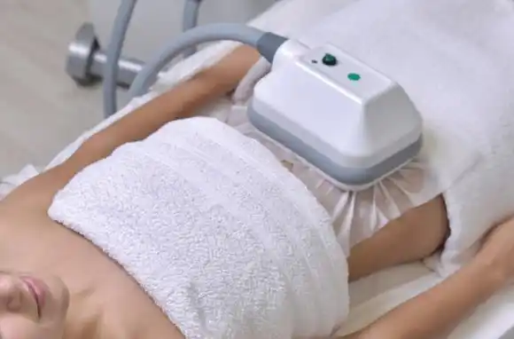 Criolipólisis: el tratamiento que promete reducir medidas