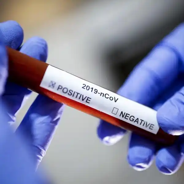 El Departamento Concordia confirmó 80 nuevos casos de coronavirus
