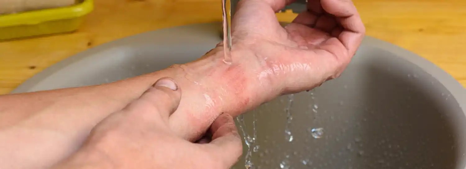 Una vez controlado el fuego, el siguiente paso es el enfriamiento térmico.