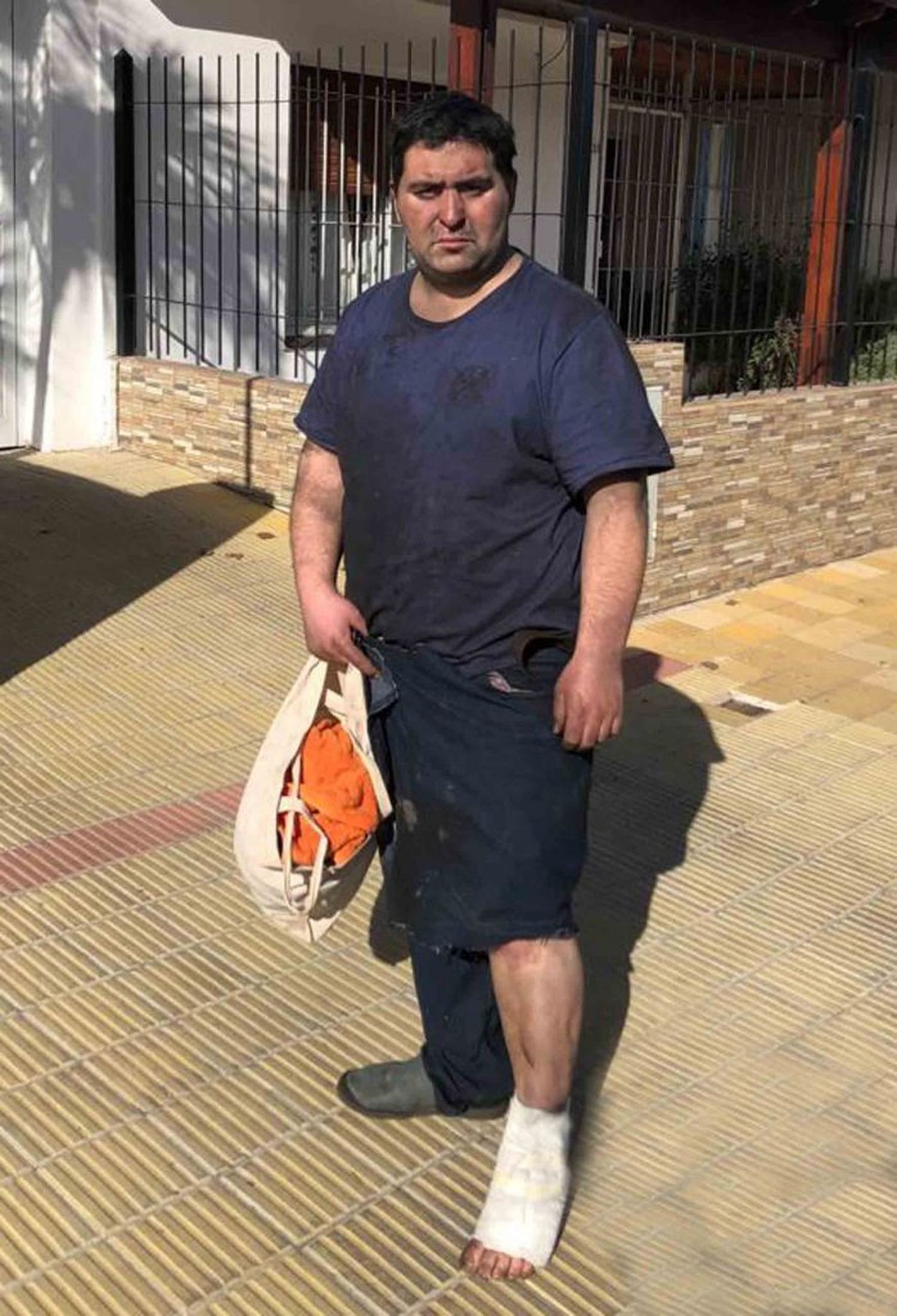 Un hombre debió ser trasladado al Hospital luego de sufrir un incendio en su departamento
