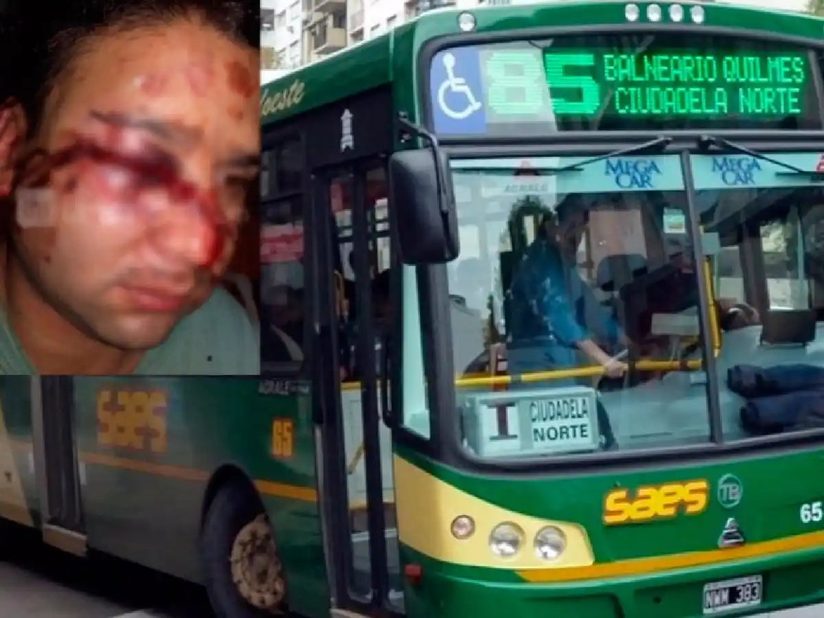Quilmes: desfiguraron a otro chofer de colectivos