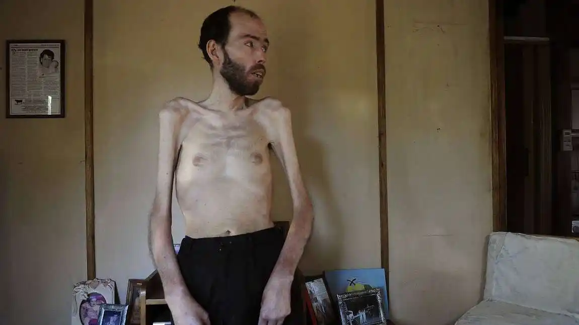 El glifosato no sólo causaría cáncer, sino que haría más daño del que se suponía