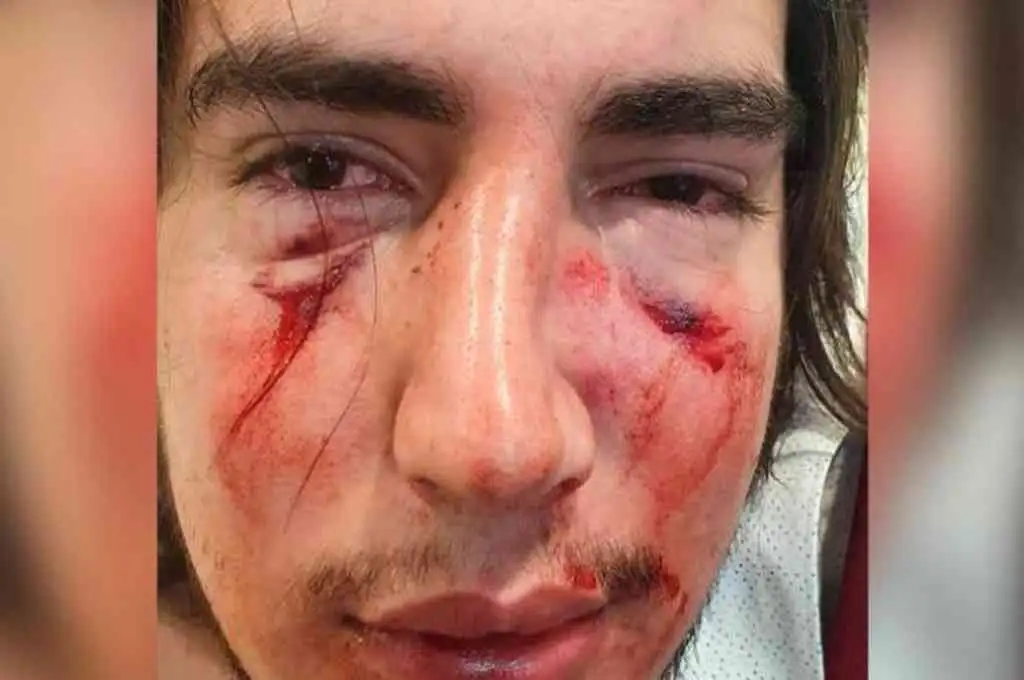 Imputaron a dos rugbiers por la golpiza a un joven en una fiesta privada en Córdoba