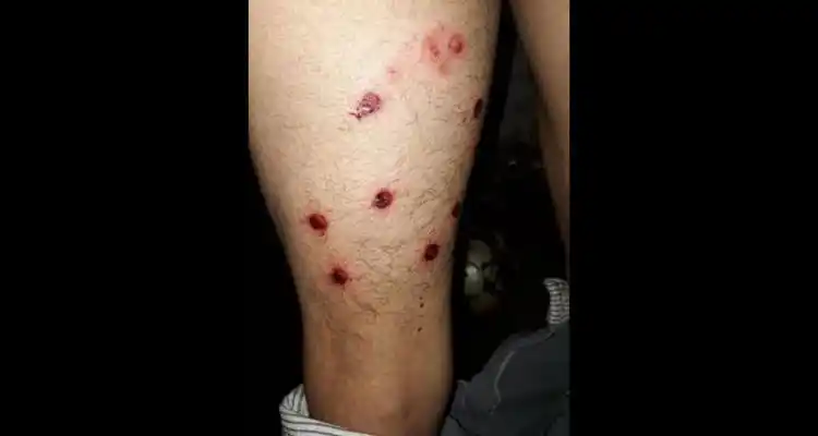 “Me lo devolvieron baleado”, dijo la madre de un menor atrapado por la policía