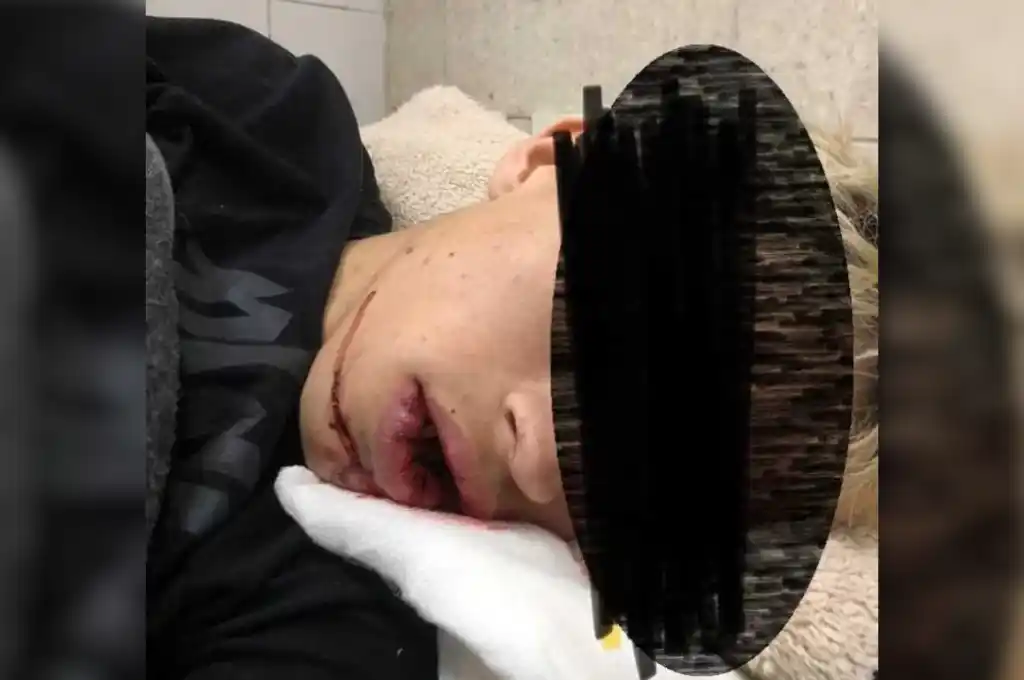 La víctima está internada en el Hospital Zonal Nuestra Señora de Luján debido a las graves lesiones.