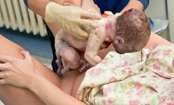 La Organización Mundial de la Salud (OMS) recomienda en su informe de 2012: 