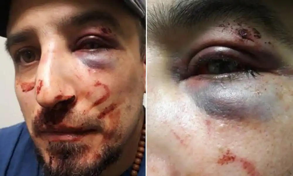 Locura en Bahía Blanca: Desafectan a policías que dieron feroz golpiza a joven que paseaba al perro