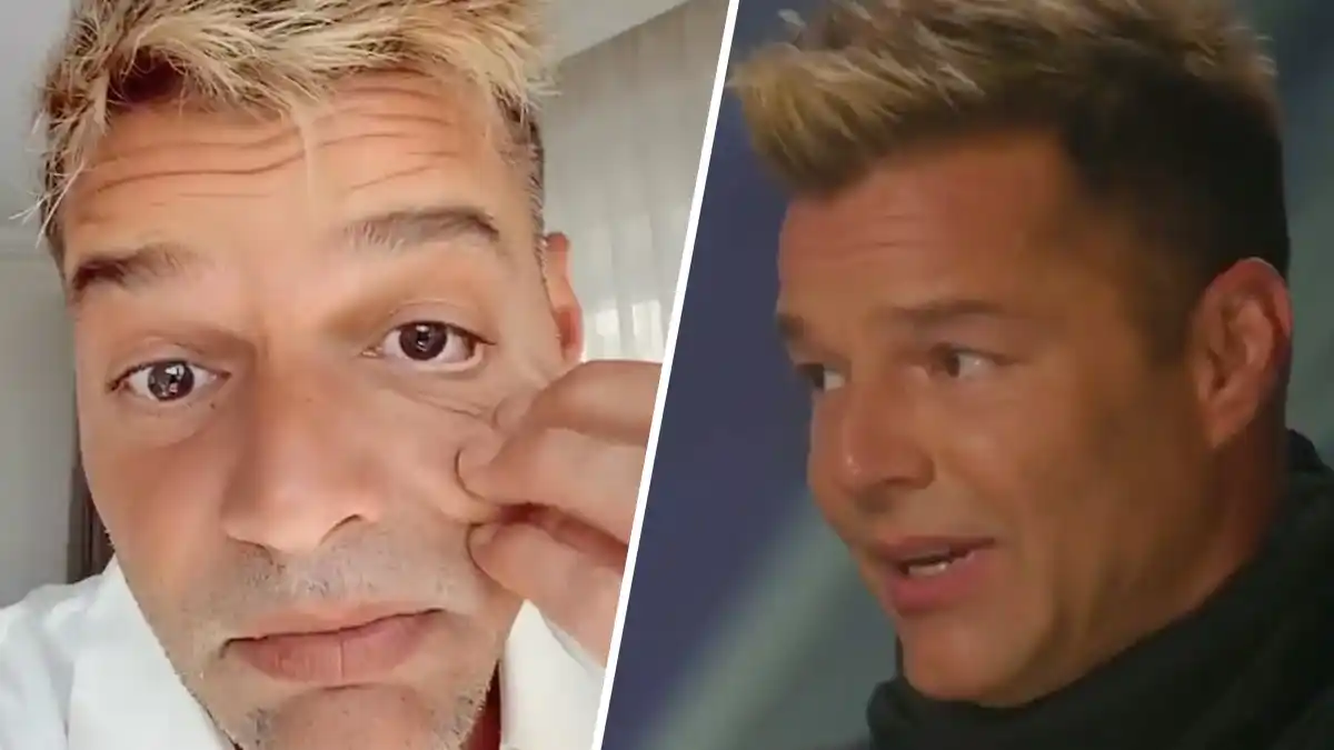 Ricky Martin negó haberse hecho cirugía: su explicación de por qué le cambió la cara