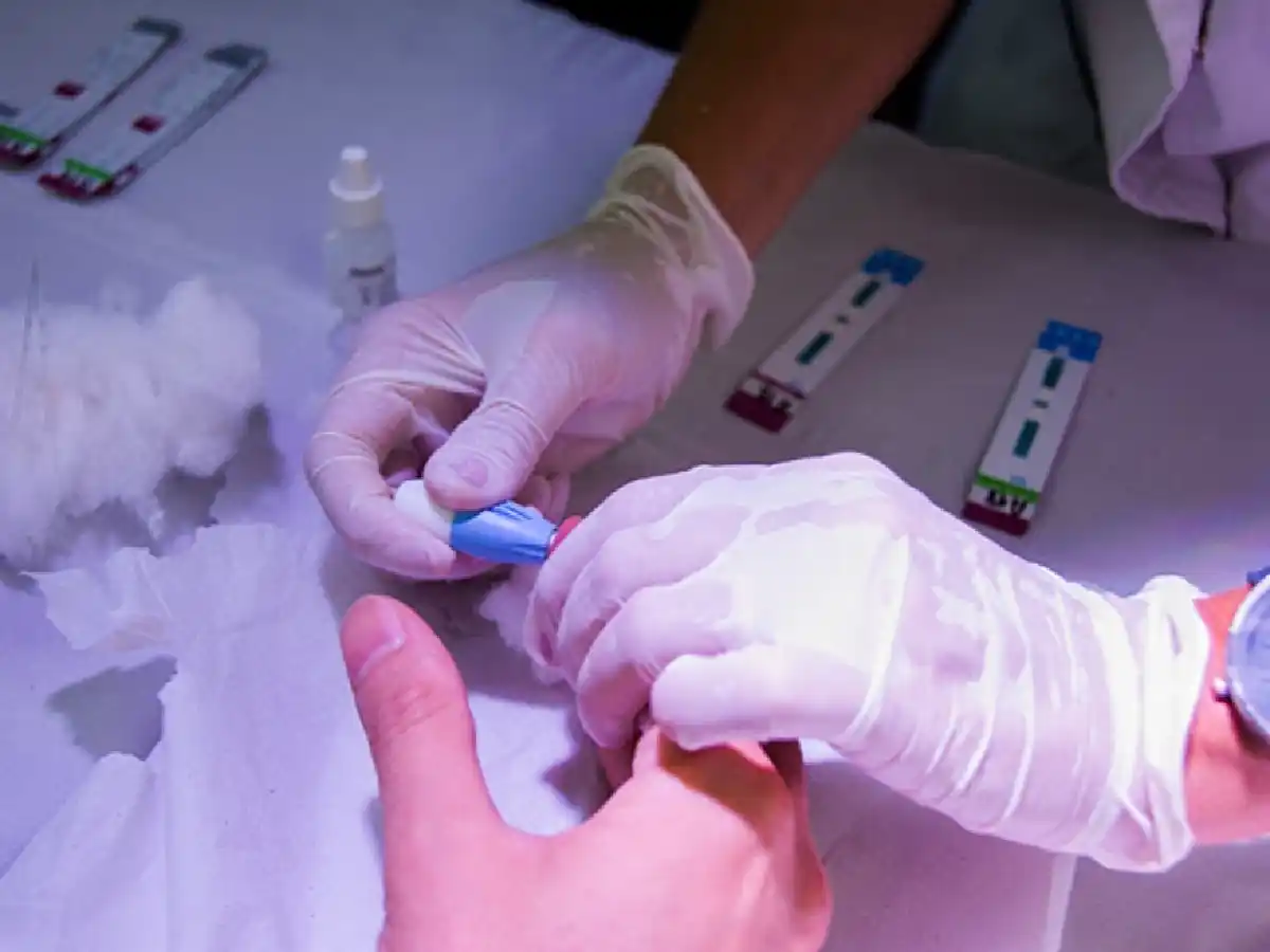 En 2020 se notificaron 529 casos de VIH en la provincia de Córdoba