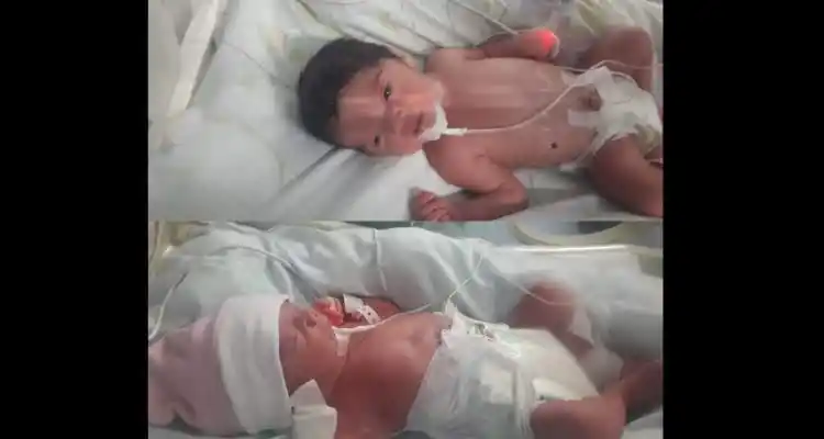 Las primeras gemelas de San Pedro del 2020