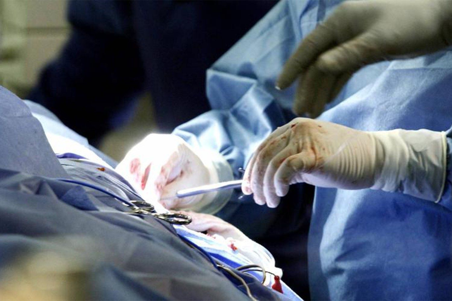 Argentina: en 2019 se superó la marca histórica de donantes y trasplantes