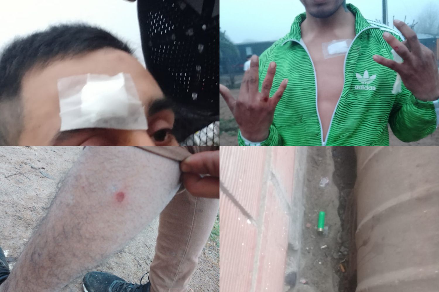 Río Tala: conflicto en un barrio terminó con varios heridos por balas de goma que disparó la Policía