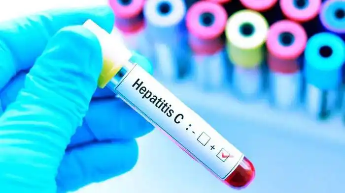 Es sumamente importante tomar medidas de prevención para disminuir la circulación del virus de la hepatitis