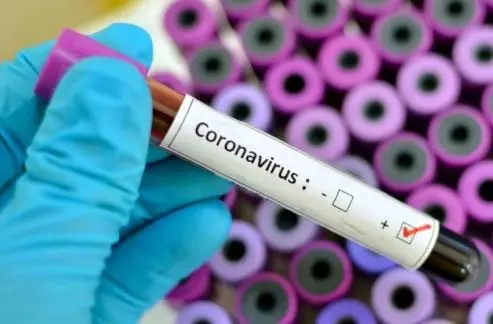 Se suman 5.641 nuevos casos de coronavirus y otras 110 muertes