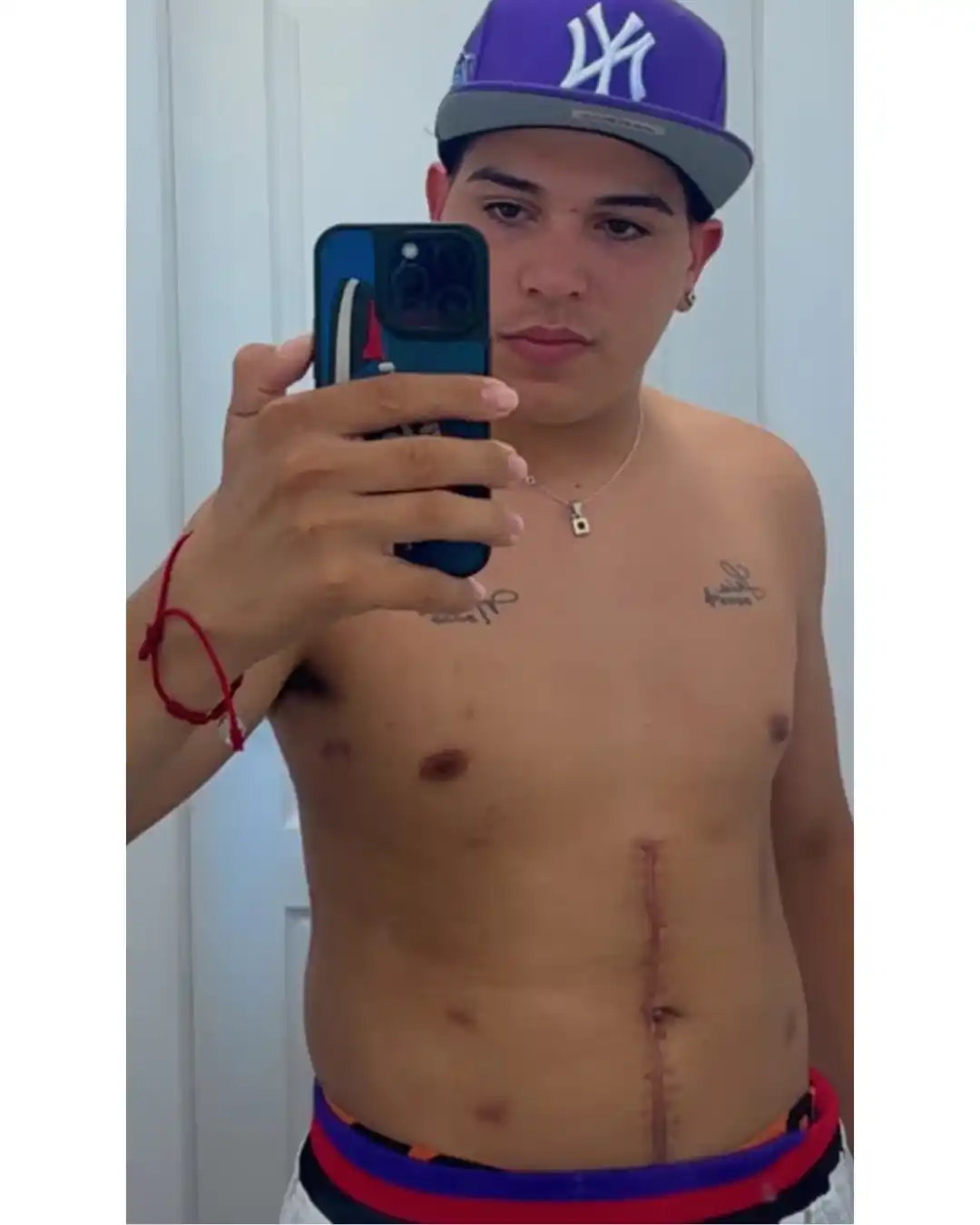 thiago medina cicatrices