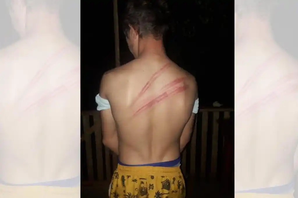 Pasan a disponibilidad a siete policías de Misiones por agresión a un joven