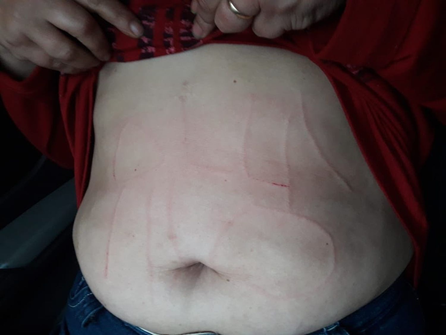 Denuncian el secuestro de una maestra: le escribieron en la panza “Ollas no” con un punzón