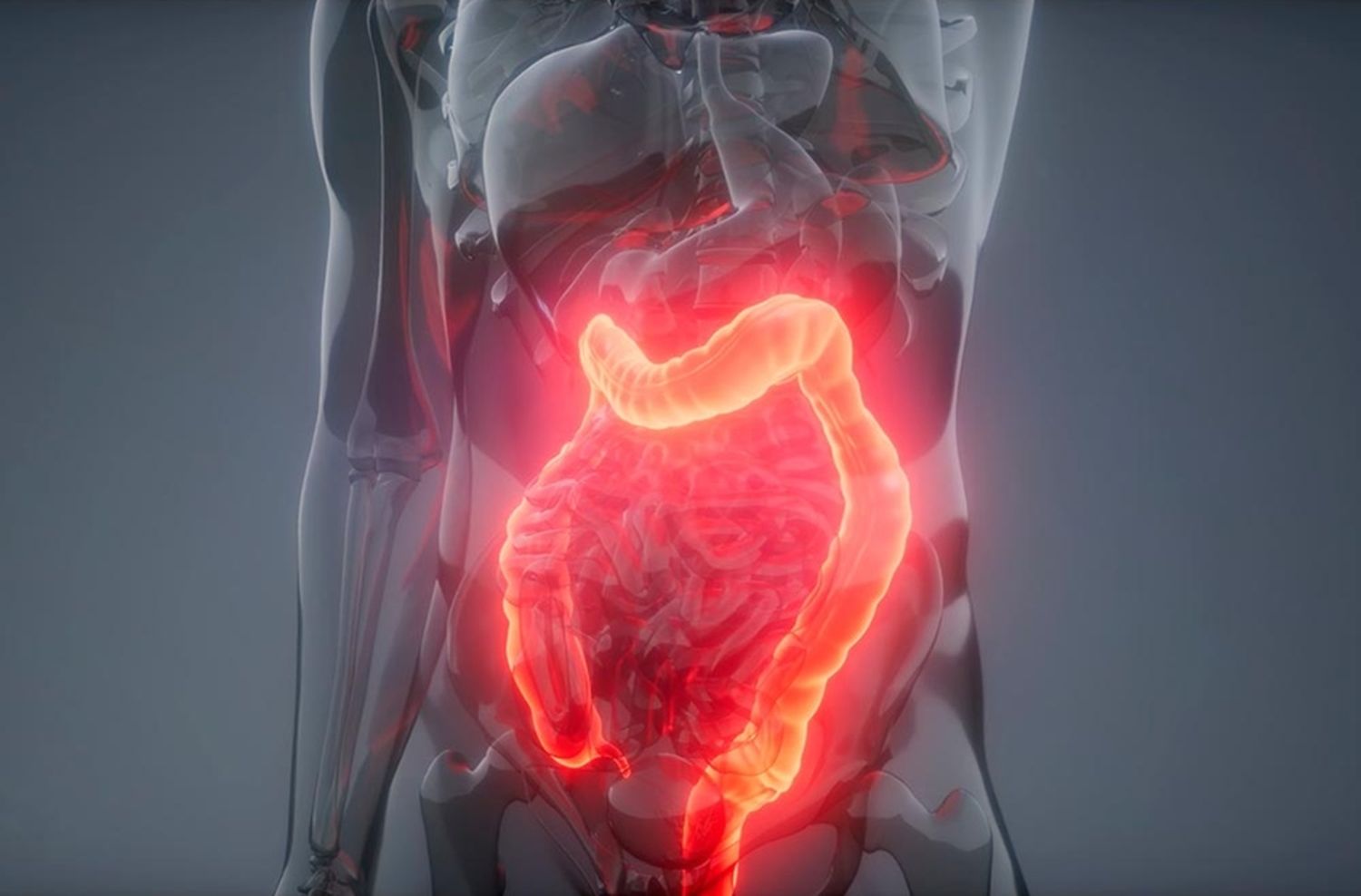 Colon Irritable y Alimentación: Una Relación Fundamental para el Bienestar Digestivo