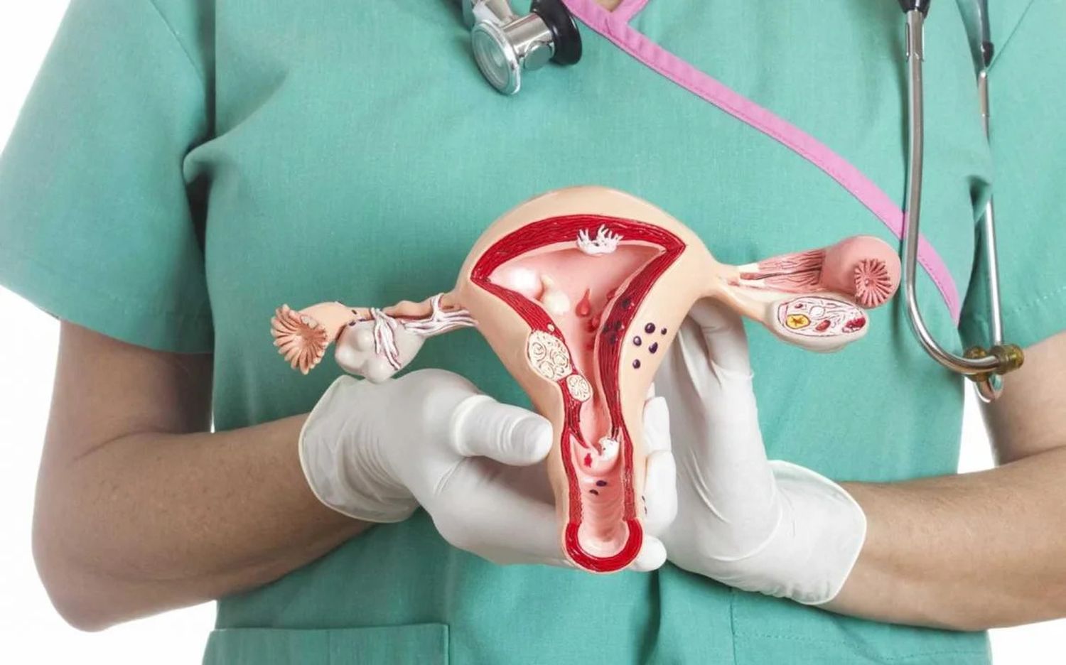 Se estima que 7 de cada 10 mujeres llegan tarde al diagnóstico.
