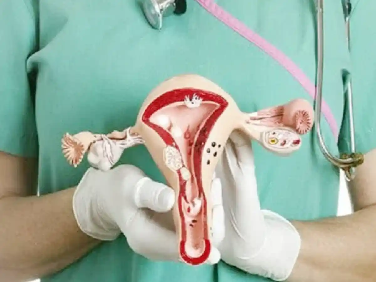 Cáncer uterino: 9 de cada 10 casos se podrían prevenir con controles ginecológicos 