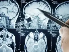 El CONICET identifica una estrategia para mejorar la eficacia de la quimioterapia en tumores cerebrales