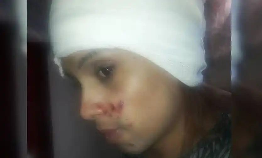La víctima recibió varios golpes en la cabeza y heridas en el rostro.