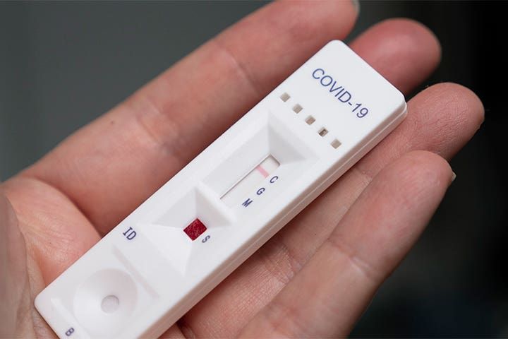 ANMAT autorizó el uso libre de cuatro autotest de COVID-19: Son importados y habrá que esperar