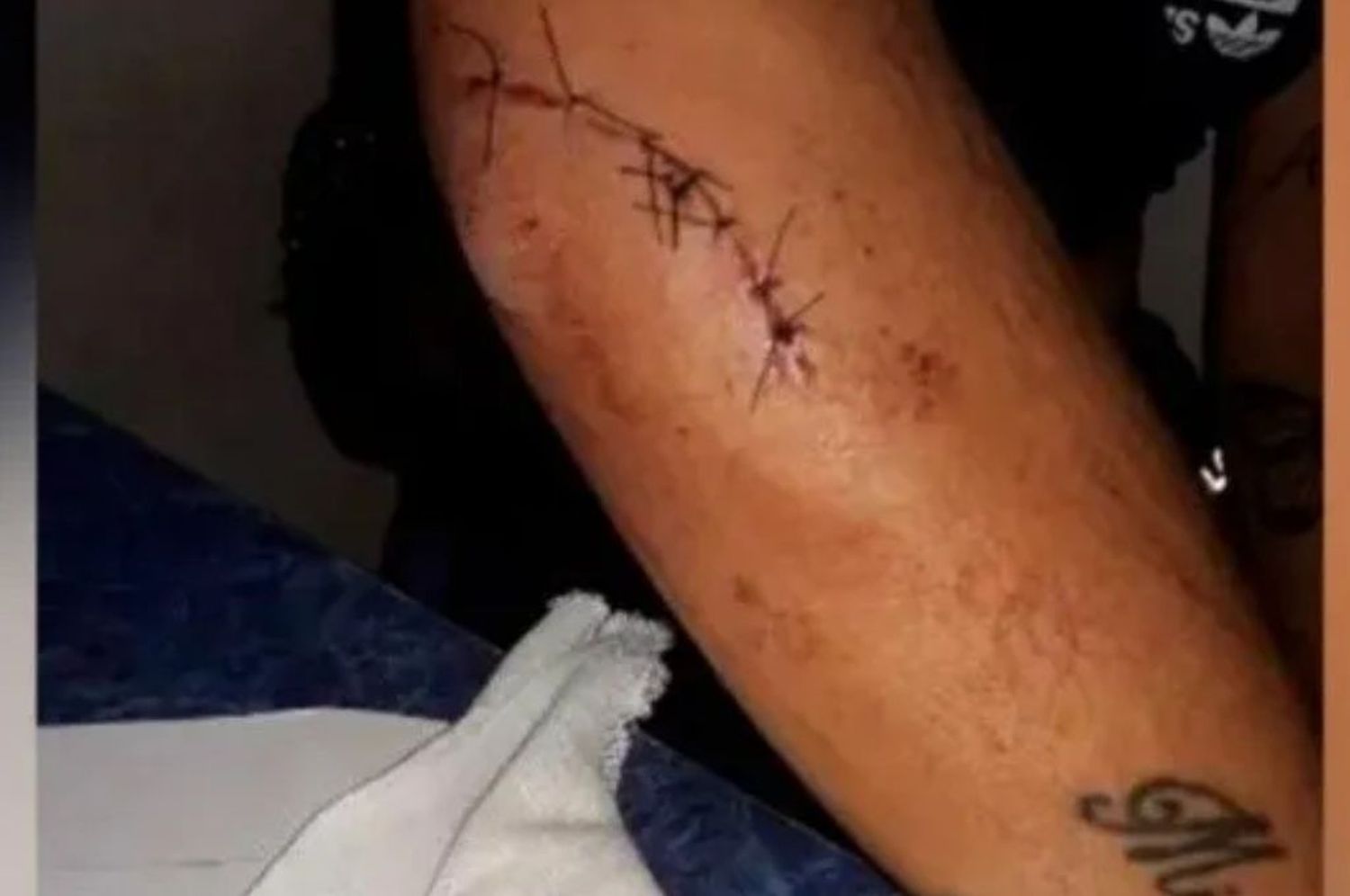 Una joven denunció que fue brutalmente agredida por dos patovicas en un bar