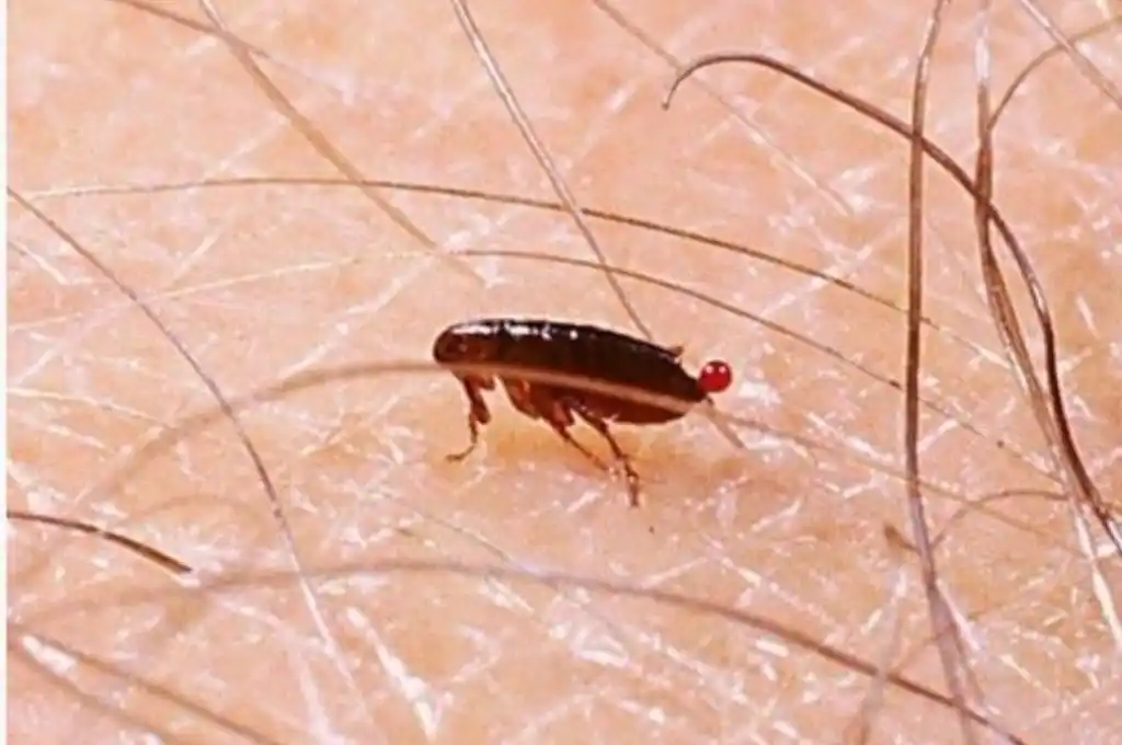 Investigan si las pulgas ocasionan cuadros febriles en humanos