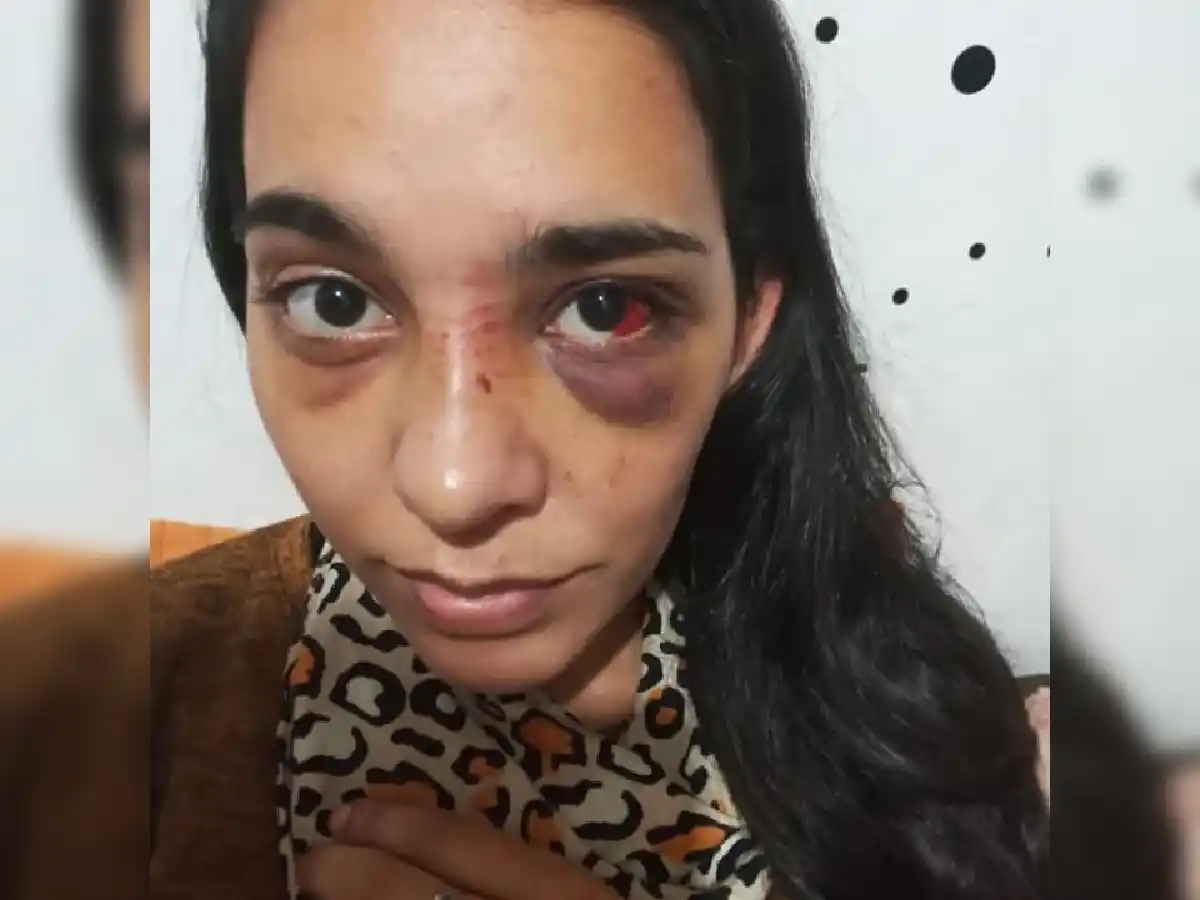 “Sorprendida por el nivel de agresión de tres personas que recibí solo para robarme mi celular”