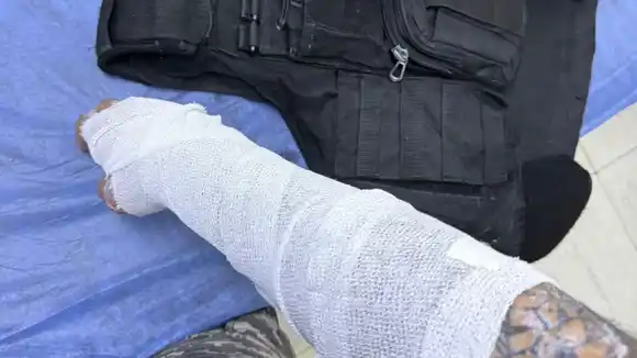 Un hombre atacó a su madre y arrojó agua caliente a dos policías