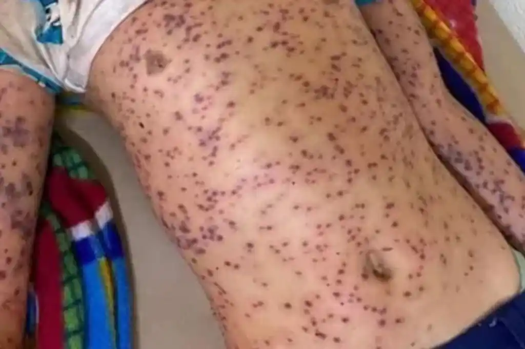 Desbarranca bus en Nicaragua y cae sobre panal de abejas asesinas: 6 muertos