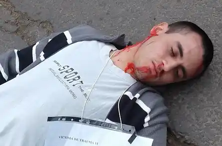 La importancia de los primeros auxilios: choque entre una moto y una camioneta